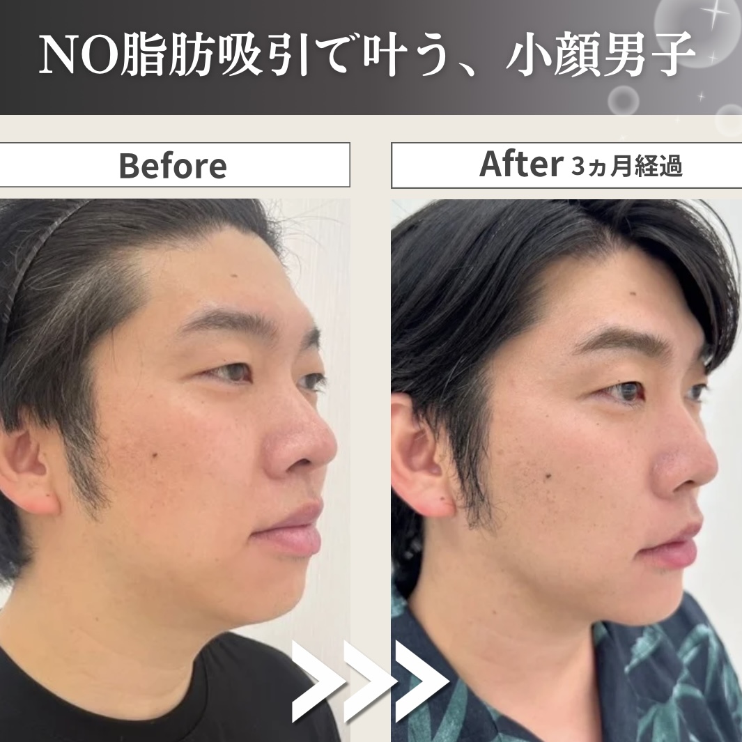 キャンペンバナー