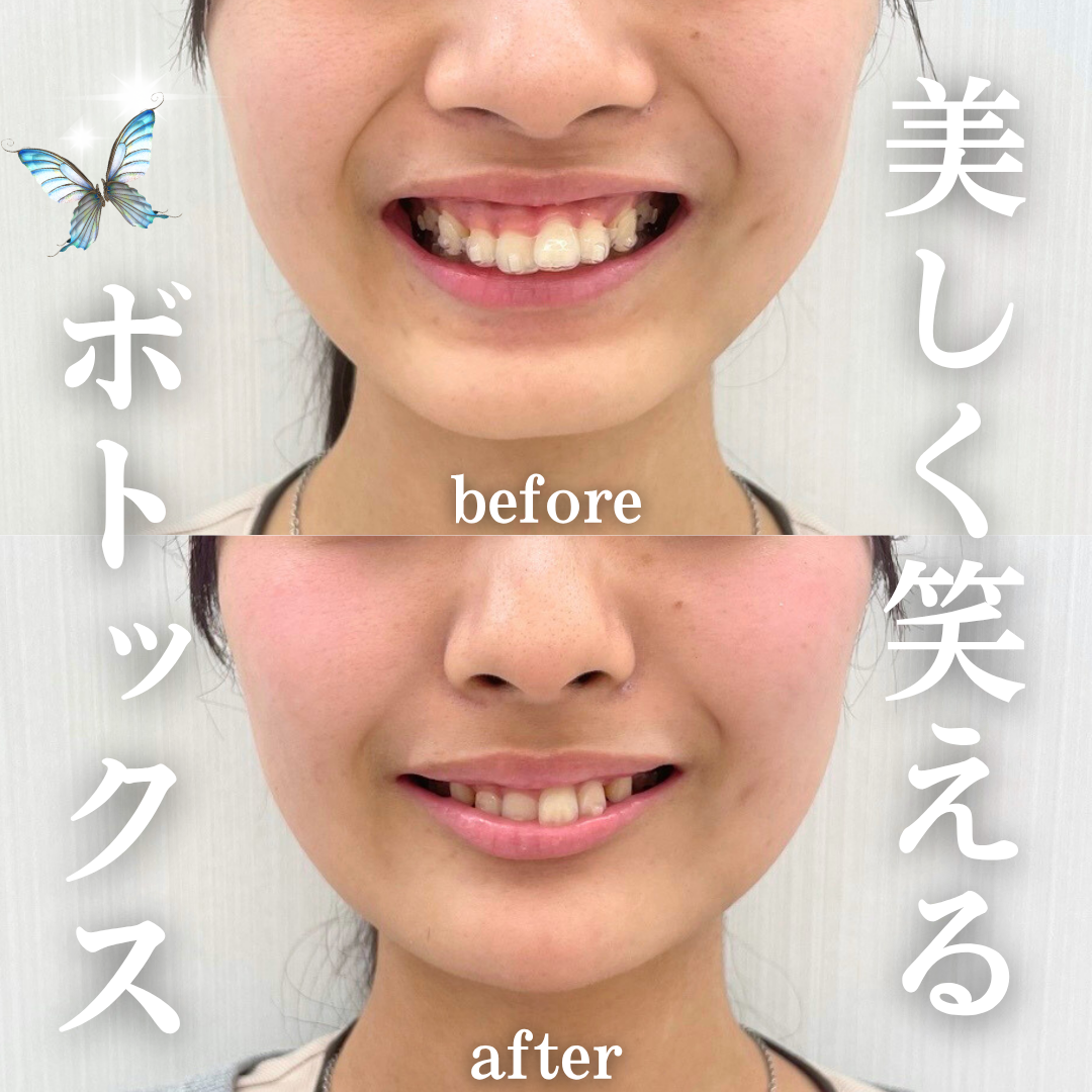 キャンペンバナー