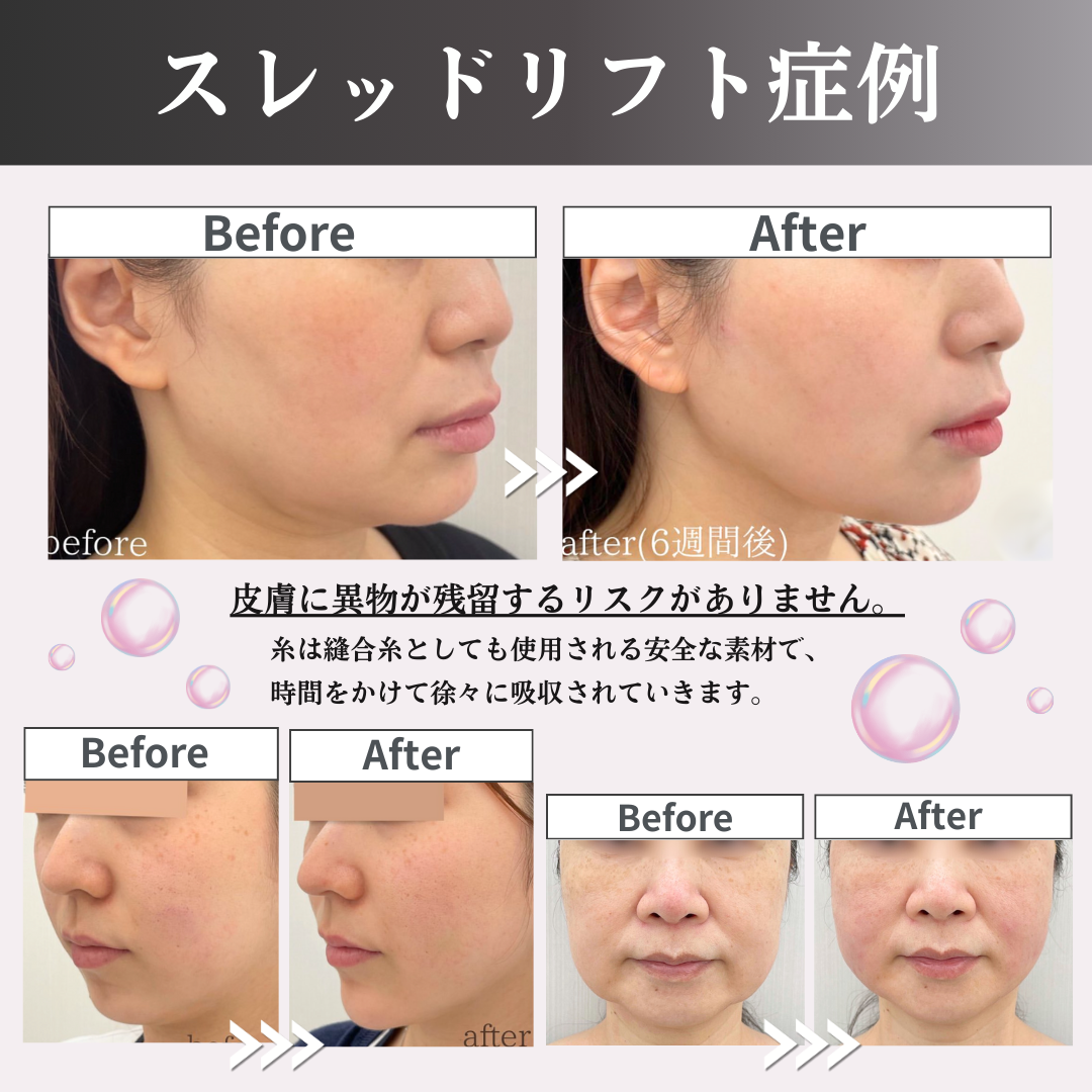 キャンペンバナー