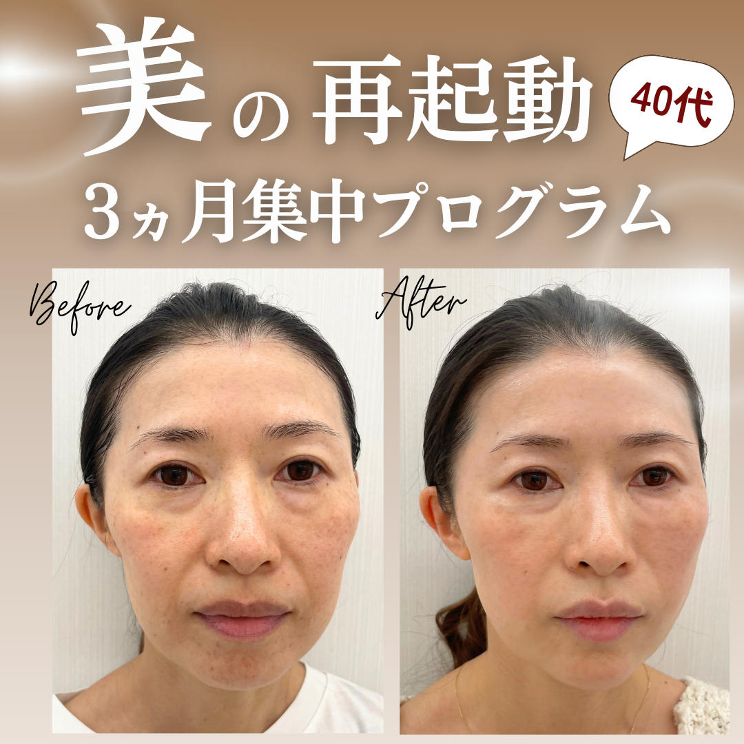 キャンペンバナー