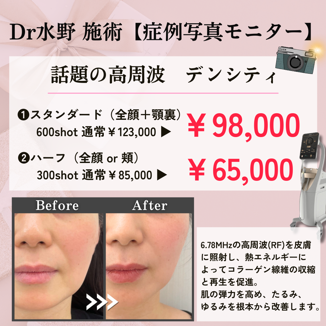 キャンペンバナー