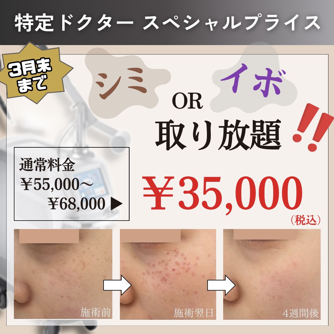 キャンペンバナー