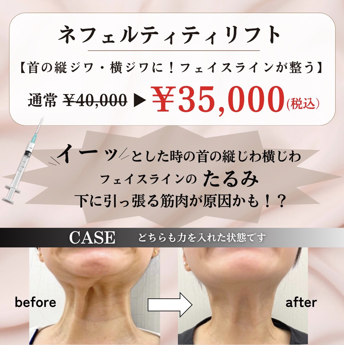 キャンペンバナー