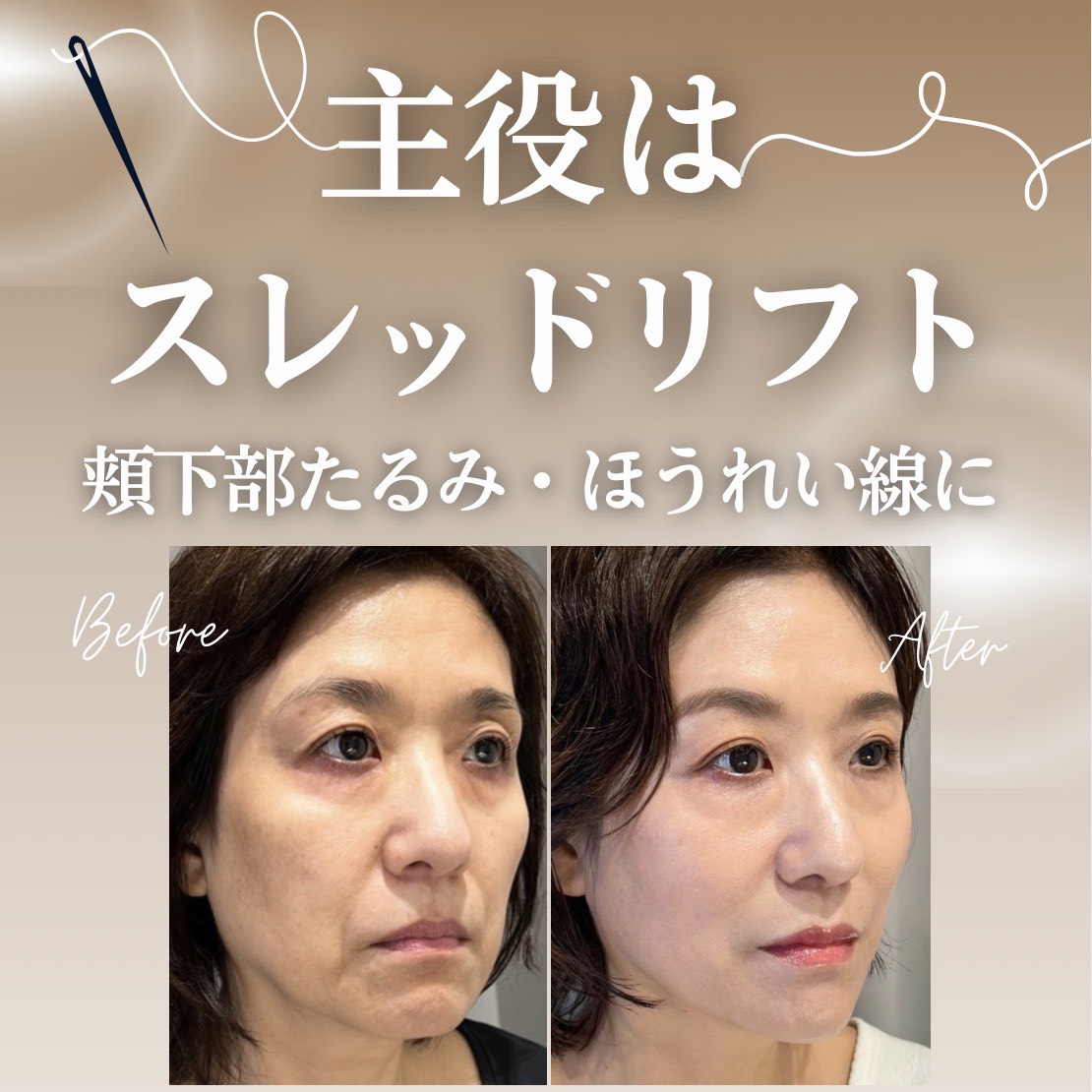 キャンペンバナー