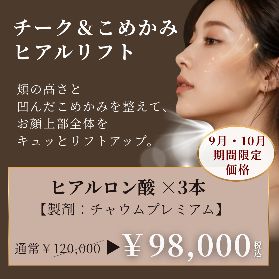 キャンペンバナー