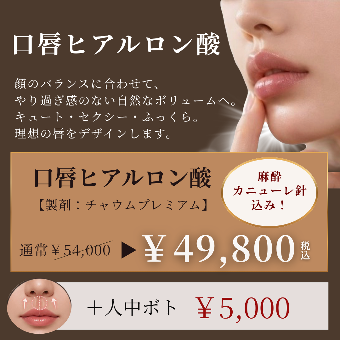 キャンペンバナー