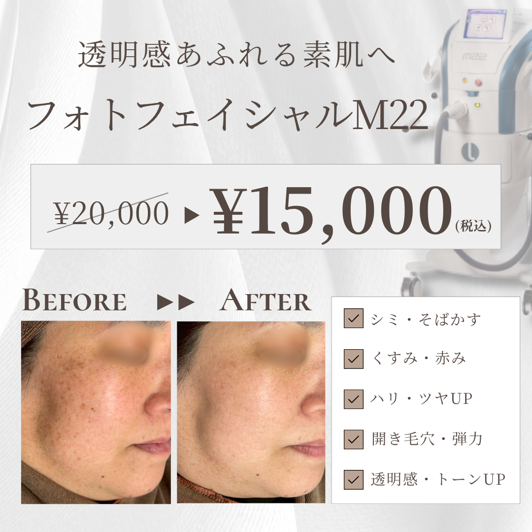 キャンペンバナー