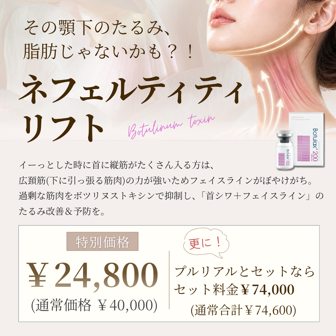 キャンペンバナー